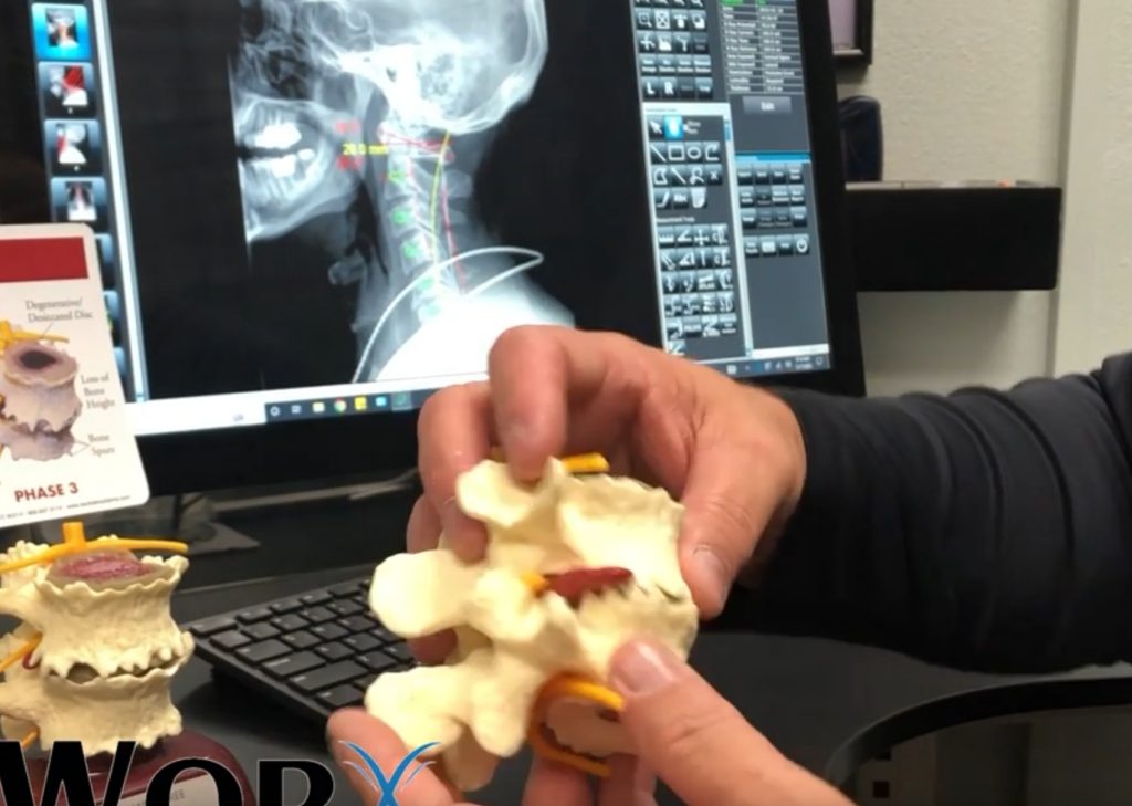 Chiropractor in Frisco TX Chiropractor in Frisco TX